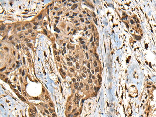 CCDC113 Antibody
