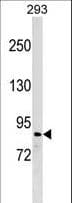 Polyclonal Rabbit anti-Human ZNF7 Antibody (aa595-625, WB)