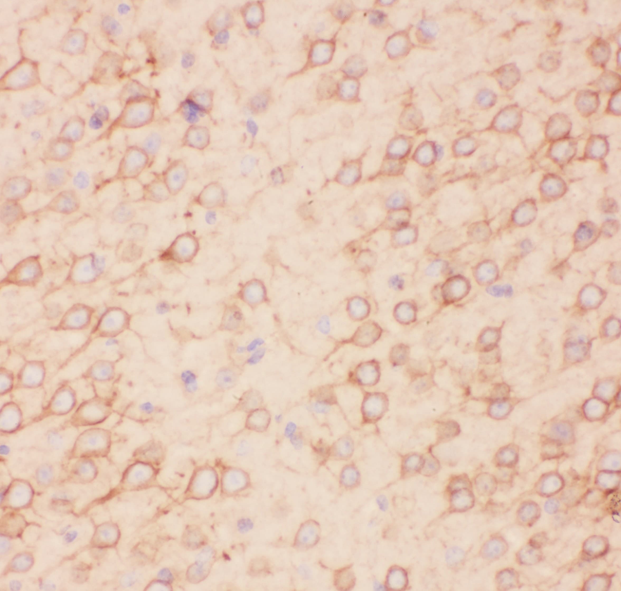 KCNB1 / Kv2.1 Antibody (aa687-858)