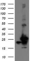 Monoclonal Mouse anti-Human VBP1 Antibody (clone OTI2C2, IHC, WB)