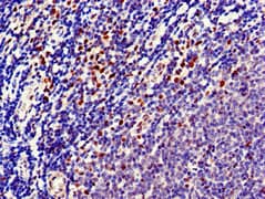 Polyclonal Rabbit anti-Human MPS1 / TTK Antibody (IHC, IF)