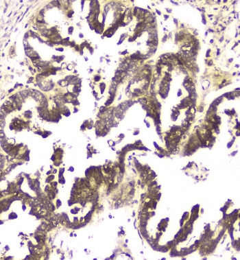 Polyclonal Rabbit anti-Human MCUR1 / CCDC90A Antibody (IHC, WB)