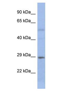 STEAP1B Antibody (aa64-113)