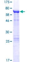 Human KRT36 / Keratin 36 / KRTHA6 Protein (Recombinant GST)