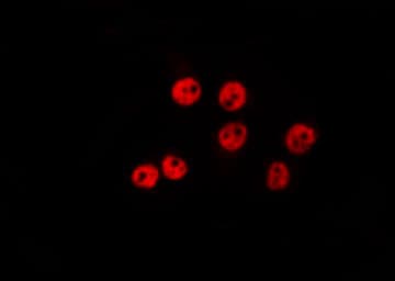 Polyclonal Rabbit anti-Human ZNF575 Antibody (IF, WB)