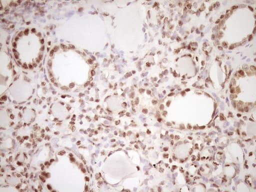 LPIN1 / Lipin 1 Antibody (clone OTI8F10)