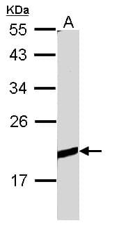 IHC-plus™ BCL2L10 / Diva Antibody (aa60-153)