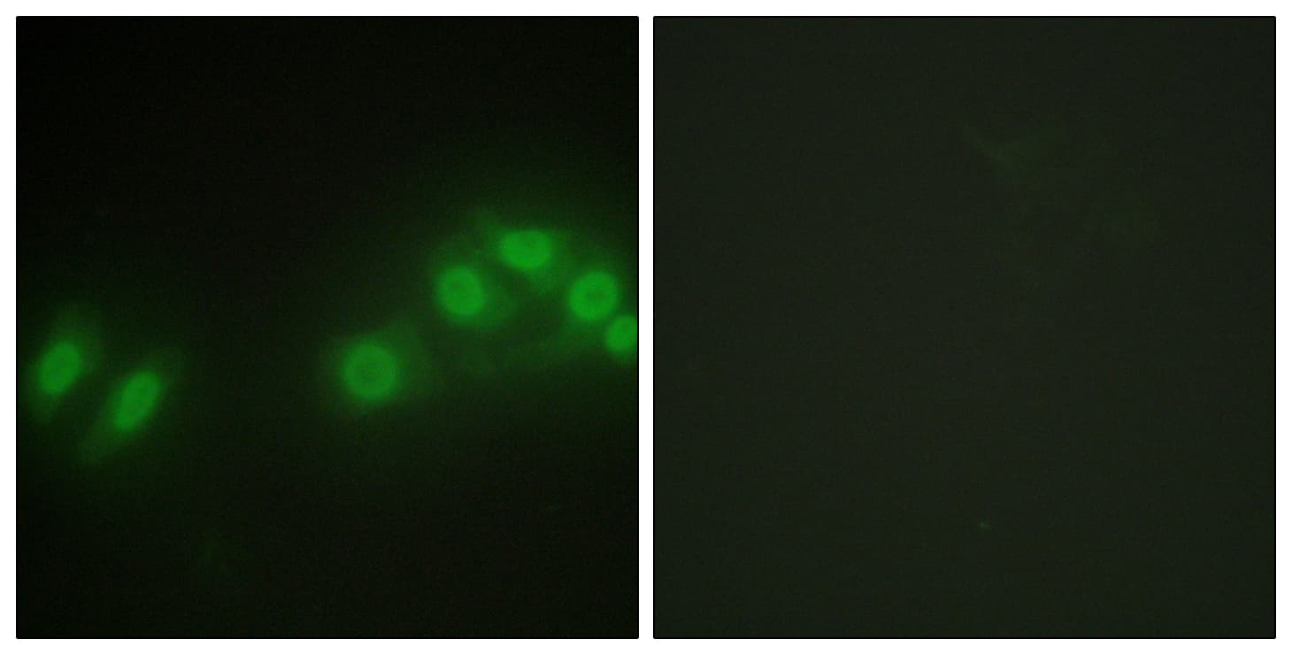 LATS2 Antibody (aa541-590)