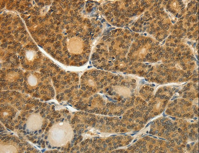 Polyclonal Rabbit anti-Human SOCS5 Antibody (IHC)