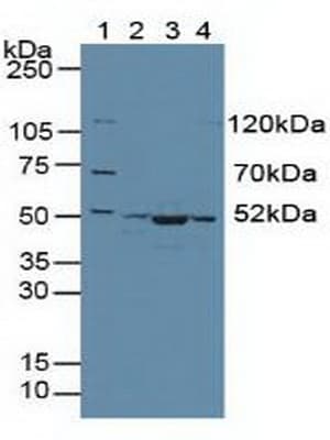 CS / Citrate Synthase Antibody (aa174-428)