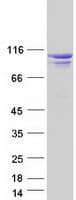 Human OCRL Protein (Recombinant Myc-DDK (Flag))