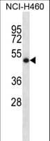 Polyclonal Rabbit anti-Human SOCS4 Antibody (aa224-253, WB)