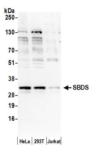 SBDS Antibody (aa175-225)