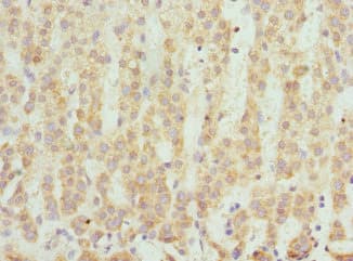 Polyclonal Rabbit anti-Human SCO2 Antibody (IHC)