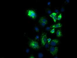 PKMYT1 Antibody (clone OTI1C3)