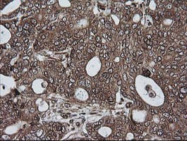 Monoclonal Mouse anti-Human RIOK2 Antibody (clone OTI3E11, IHC, IF, WB)