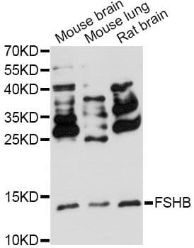 FSHB / FSH Beta Antibody