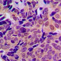 APP / Beta Amyloid Precursor Antibody (phospho-Thr743)