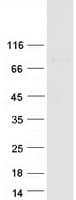Human ZNF567 Protein (Recombinant Myc-DDK (Flag))