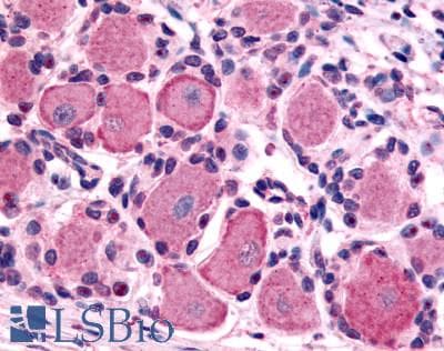 IHC-plus™ HTR1D / 5-HT1D Receptor Antibody (Cytoplasmic Domain)