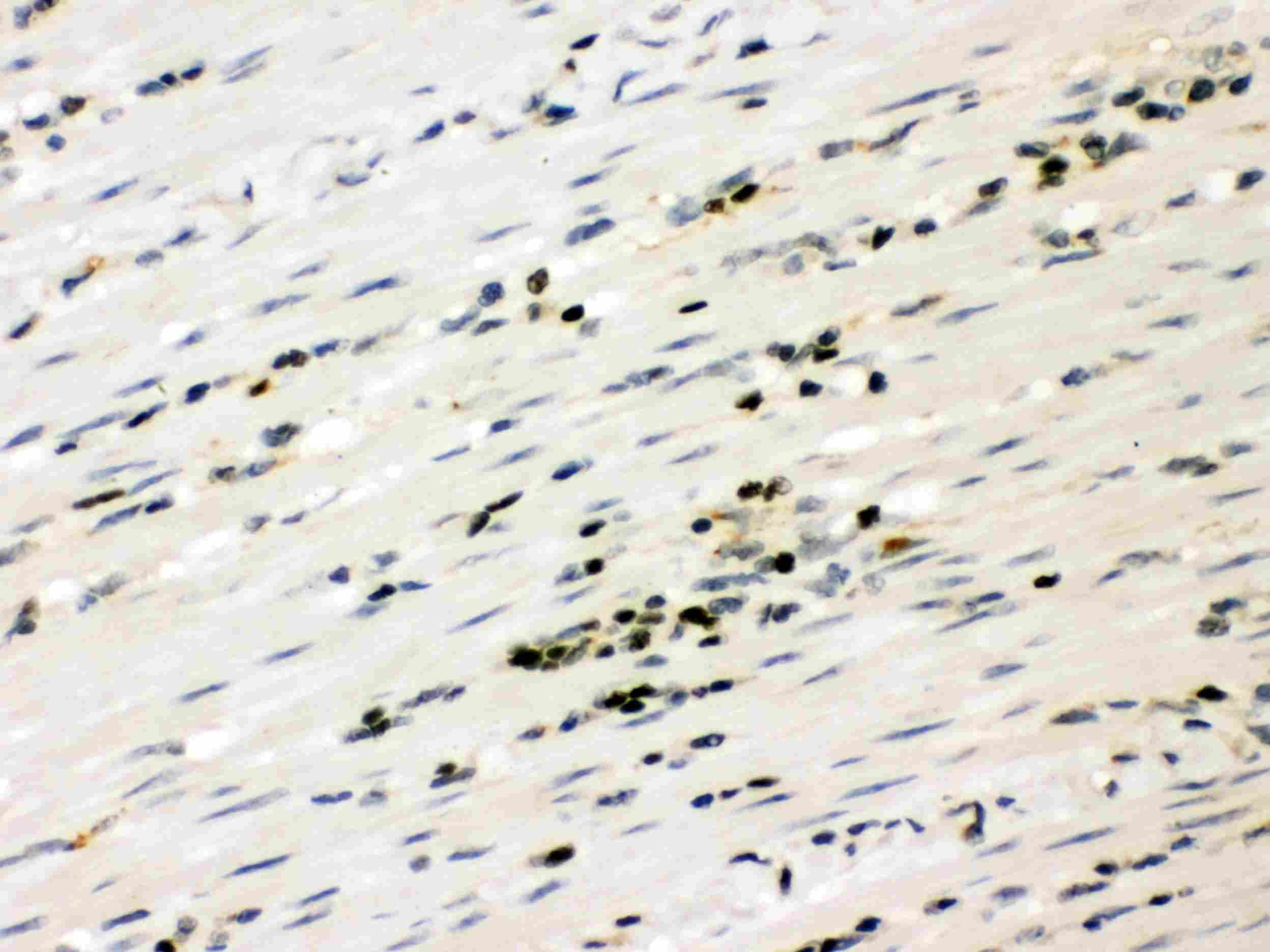 Polyclonal Rabbit anti-Human RUNX3 Antibody (IHC, WB)