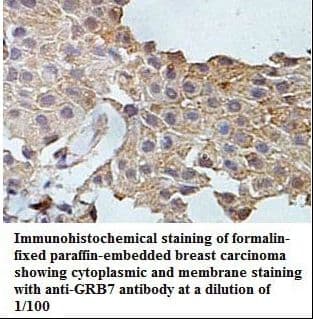 GRB7 Antibody (aa35-201)