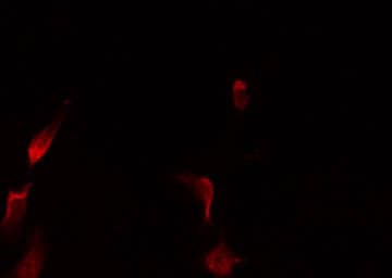 Polyclonal Rabbit anti-Human NFAT4 / NFATC3 Antibody (phospho-Ser165, IF, WB)