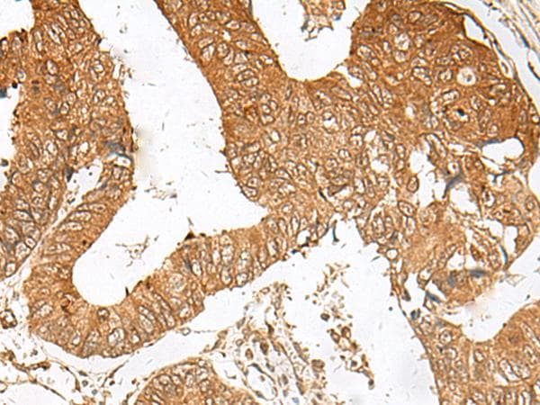 zinc finger and BTB domain containing 8 Antibody