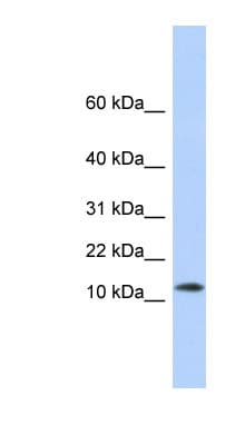 MAP1LC3A / LC3A Antibody (N-Terminus)