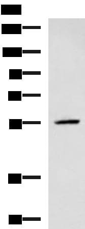 Polyclonal Rabbit anti-Human Translokin / CEP57 Antibody (WB)
