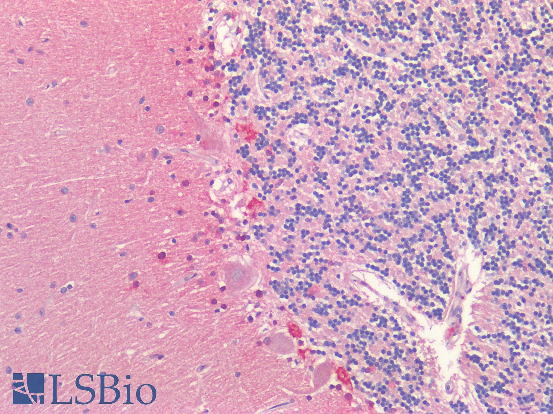 PathPlus™ Polyclonal Rabbit anti-Human KCNA2 / Kv1.2 Antibody (IHC, IF, WB)