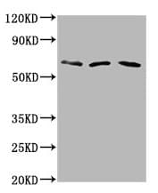 Polyclonal Rabbit anti-Human PHACTR1 Antibody (IHC, IF, WB)