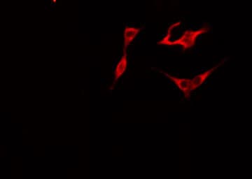 STARD10 Antibody