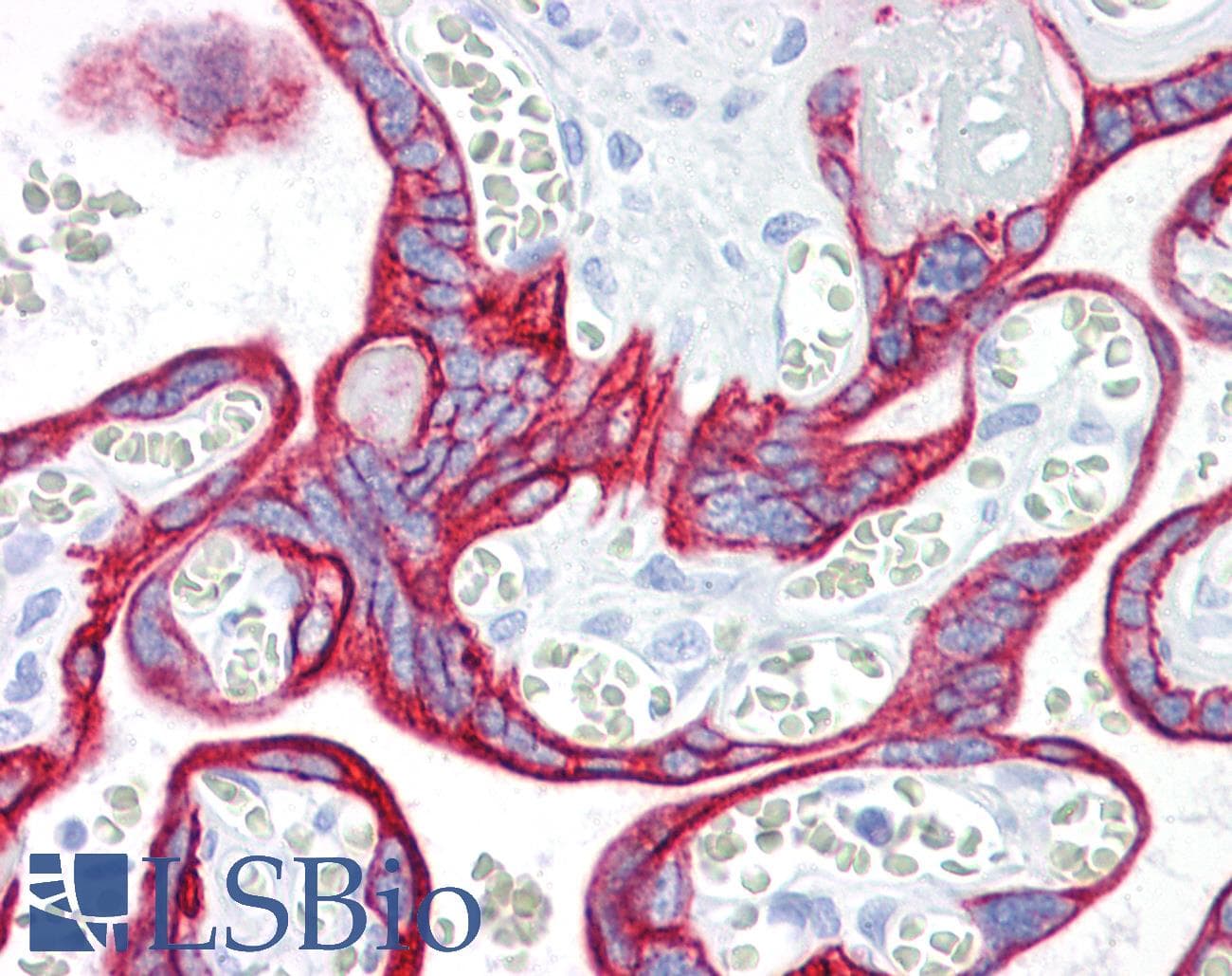 PathPlus™ Monoclonal Mouse anti-Human KRT7 / CK7 / Cytokeratin 7 Antibody (clone OVTL12/30, IHC, WB)