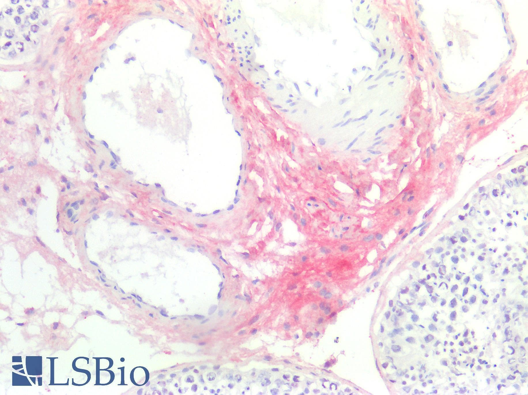 IHC-plus™ DCN / Decorin Antibody