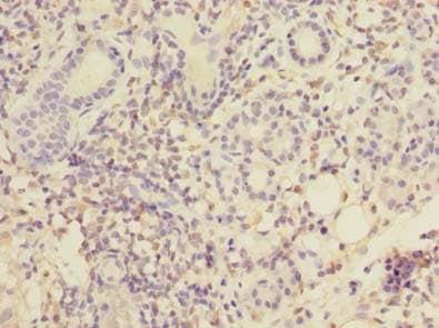 Polyclonal Rabbit anti-Human MPPED1 Antibody (IHC)