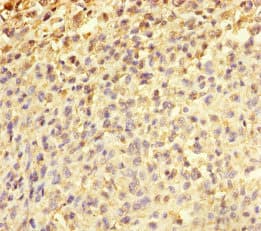 TMEFF2 Antibody (aa41-320)