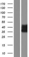 RAB34 Protein (Over-Expression Lysate Myc-DDK (Flag))
