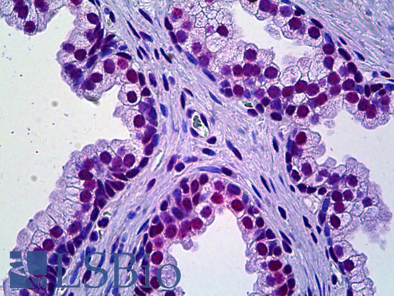 IHC-plus™ PRKDC / DNA-PKcs Antibody (clone 2A8)