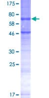 Human STEAP2 Protein (Recombinant GST)