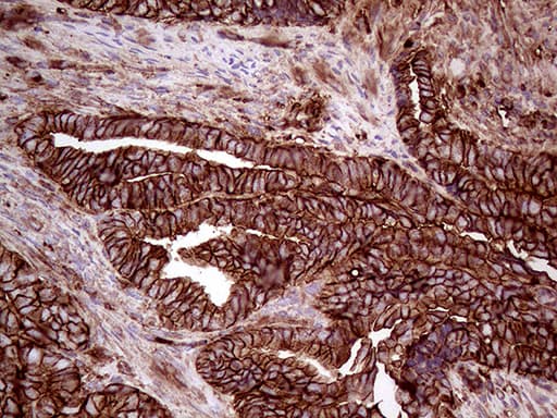 IQGAP1 Antibody (aa464-609, clone OTI6E1)