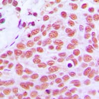 Polyclonal Rabbit anti-Human JUN / c-Jun Antibody (Internal, IHC, WB)