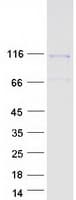 Human DAAM1 Protein (Recombinant Myc-DDK (Flag))