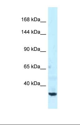 Polyclonal Rabbit anti-Human SPTBN1 / ELF Antibody (C-Terminus, WB)