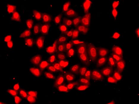 Polyclonal Rabbit anti-Human CAMK1D Antibody (IHC, IF, WB)