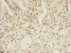 MSH6 Antibody (aa1-400)