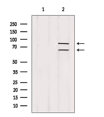Polyclonal Rabbit anti-Human MLPH / Melanophilin Antibody (IHC, WB)