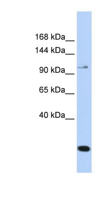 TRPC6 Antibody (N-Terminus)
