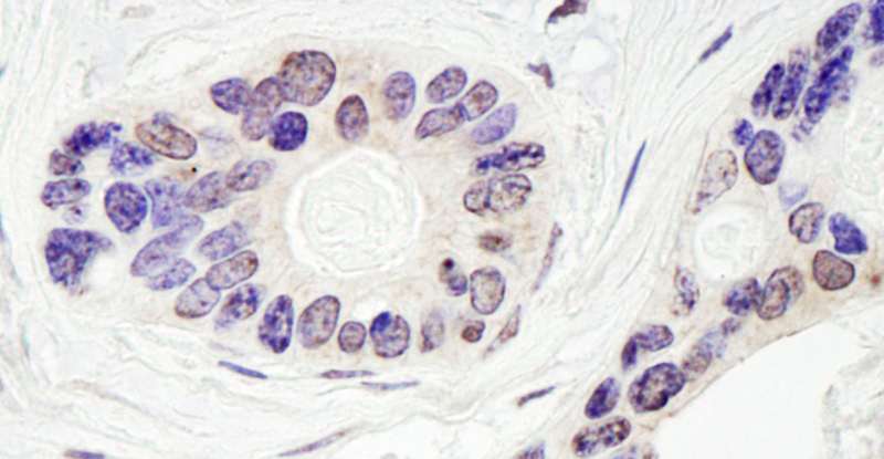 TDP1 Antibody (aa1-50)