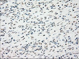 CHEK2 / CHK2 Antibody (clone OTI10G7)
